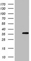 ZFAND1 Antibody - HEK293T cells were transfected with the pCMV6-ENTRY control (Left lane) or pCMV6-ENTRY ZFAND1 (Right lane) cDNA for 48 hrs and lysed. Equivalent amounts of cell lysates (5 ug per lane) were separated by SDS-PAGE and immunoblotted with Rabbit anti-ZFAND1 polyclonal antibody at 1:500 antibody.
