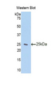 ZFAND6 Antibody - Western blot of recombinant ZFAND6.  This image was taken for the unconjugated form of this product. Other forms have not been tested.