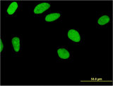Zfp105 / ZNF35 Antibody - Immunofluorescence of monoclonal antibody to ZNF35 on HeLa cell . [antibody concentration 10 ug/ml]
