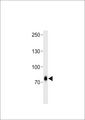 ZFP219 / ZNF219 Antibody - ZNF219 Antibody western blot of CEM cell line lysates (35 ug/lane). The ZNF219 antibody detected the ZNF219 protein (arrow).