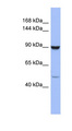 ZFP28 Antibody - ZFP28 antibody Western blot of COLO205 cell lysate. This image was taken for the unconjugated form of this product. Other forms have not been tested.