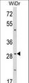 ZFP36 / Tristetraprolin Antibody - Western blot of ZFP36 Antibody in WiDr cell line lysates (35 ug/lane). ZFP36 (arrow) was detected using the purified antibody.