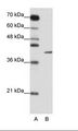 ZFP42 / REX-1 Antibody - A: Marker, B: Jurkat Cell Lysate.  This image was taken for the unconjugated form of this product. Other forms have not been tested.