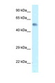 Zfp472 Antibody - Zfp472 antibody Western blot of Mouse Brain lysate. Antibody concentration 1 ug/ml.  This image was taken for the unconjugated form of this product. Other forms have not been tested.