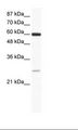 ZFP91 Antibody - Jurkat Cell Lysate.  This image was taken for the unconjugated form of this product. Other forms have not been tested.