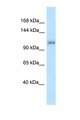 ZFR Antibody - ZFR antibody Western blot of Mouse Liver lysate. Antibody concentration 1 ug/ml.  This image was taken for the unconjugated form of this product. Other forms have not been tested.