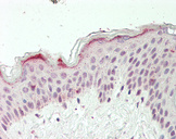 ZFX Antibody - Human Skin: Formalin-Fixed, Paraffin-Embedded (FFPE).  This image was taken for the unconjugated form of this product. Other forms have not been tested.
