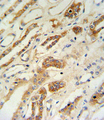 ZFYVE16 Antibody - ZFYVE16 Antibody IHC of formalin-fixed and paraffin-embedded lung tissue followed by peroxidase-conjugated secondary antibody and DAB staining.