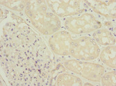 ZFYVE16 Antibody - Immunohistochemistry of paraffin-embedded human kidney tissue at dilution 1:100