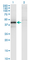 ZFYVE19 Antibody - Western blot of ZFYVE19 expression in transfected 293T cell line by ZFYVE19 monoclonal antibody (M02), clone 3G4-2B11.
