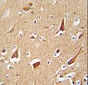 ZFYVE28 Antibody - ZFYVE28 antibody immunohistochemistry of formalin-fixed and paraffin-embedded human brain tissue followed by peroxidase-conjugated secondary antibody and DAB staining.