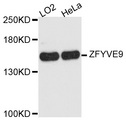 ZFYVE9 / SARA Antibody - Western blot analysis of extracts of various cell lines.