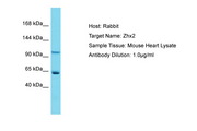 ZHX2 / RAF Antibody -  This image was taken for the unconjugated form of this product. Other forms have not been tested.