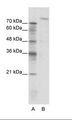 ZHX2 / RAF Antibody - A: Marker, B: Jurkat Cell Lysate.  This image was taken for the unconjugated form of this product. Other forms have not been tested.
