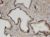 ZHX3 Antibody - Immunoperoxidase of monoclonal antibody to ZHX3 on formalin-fixed paraffin-embedded human prostate. [antibody concentration 3 ug/ml]