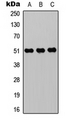 Antibody - Western blot analysis of ZIC1/2/3/4/5 expression in HEK293T (A); Raw264.7 (B); H9C2 (C) whole cell lysates.