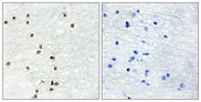 ZIC1+2+3 Antibody - Immunohistochemistry analysis of paraffin-embedded human brain tissue, using ZIC1/2/3 Antibody. The picture on the right is blocked with the synthesized peptide.