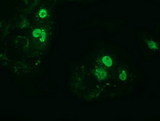 ZIM2 Antibody - Anti-ZIM2 mouse monoclonal antibody  immunofluorescent staining of COS7 cells transiently transfected by pCMV6-ENTRY ZIM2.