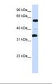 ZKSCAN1 / ZNF36 Antibody - Fetal brain lysate. Antibody concentration: 1.0 ug/ml. Gel concentration: 12%.  This image was taken for the unconjugated form of this product. Other forms have not been tested.