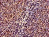 ZKSCAN3 / ZNF306 Antibody - Immunohistochemistry of paraffin-embedded human lymph node tissue using ZKSCAN3 Antibody at dilution of 1:100