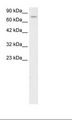 ZKSCAN5 Antibody - Jurkat Cell Lysate.  This image was taken for the unconjugated form of this product. Other forms have not been tested.