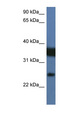 ZMAT2 Antibody - ZMAT2 antibody Western blot of Jurkat lysate. This image was taken for the unconjugated form of this product. Other forms have not been tested.