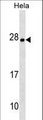 ZMAT4 Antibody - ZMAT4 Antibody western blot of HeLa cell line lysates (35 ug/lane). The ZMAT4 antibody detected the ZMAT4 protein (arrow).