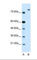 ZMYM3 Antibody - Lane A: Marker. Lane B: Transfected 293T cell lysate. Antibody concentration: 2.5 ug/ml. Gel concentration: 12%.  This image was taken for the unconjugated form of this product. Other forms have not been tested.