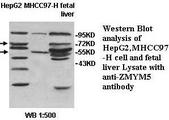 ZMYM5 Antibody