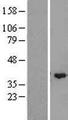 ZMYND12 Protein - Western validation with an anti-DDK antibody * L: Control HEK293 lysate R: Over-expression lysate