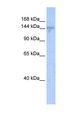 ZMYND8 / RACK7 Antibody - ZMYND8 / PRKCBP1 antibody Western blot of Fetal Brain lysate. This image was taken for the unconjugated form of this product. Other forms have not been tested.