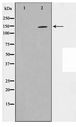 ZMYND8 / RACK7 Antibody - Western blot of 293 cell lysate using PKCB1 Antibody