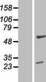 ZNF101 Protein - Western validation with an anti-DDK antibody * L: Control HEK293 lysate R: Over-expression lysate
