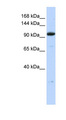 ZNF112 / ZFP112 Antibody - ZFP112 / ZNF228 antibody Western blot of MCF7 cell lysate. This image was taken for the unconjugated form of this product. Other forms have not been tested.