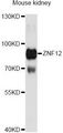 ZNF12 Antibody - Western blot analysis of extracts of mouse kidney, using ZNF12 Antibody at 1:3000 dilution. The secondary antibody used was an HRP Goat Anti-Rabbit IgG (H+L) at 1:10000 dilution. Lysates were loaded 25ug per lane and 3% nonfat dry milk in TBST was used for blocking. An ECL Kit was used for detection and the exposure time was 30s.