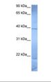 ZNF121 Antibody - Jurkat cell lysate. Antibody concentration: 1.0 ug/ml. Gel concentration: 12%.  This image was taken for the unconjugated form of this product. Other forms have not been tested.