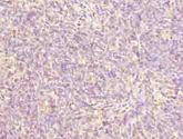 ZNF131 Antibody - Immunohistochemistry of paraffin-embedded human thymus tissue using antibody at dilution of 1:100.