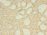 ZNF133 Antibody - Immunohistochemistry of paraffin-embedded human kidney tissue using antibody at dilution of 1:100.