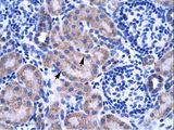 ZNF134 Antibody - ZNF134 antibody ARP35675_T100-ZNF134 (zinc finger protein 134) Antibody was used in IHC to stain formalin-fixed, paraffin-embedded human kidney.  This image was taken for the unconjugated form of this product. Other forms have not been tested.