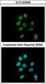 ZNF143 / STAF Antibody - Immunofluorescence of paraformaldehyde-fixed A431 using ZNF143 antibody at 1:500 dilution.