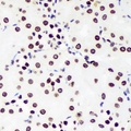 ZNF169 Antibody