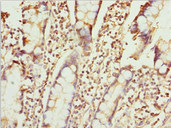ZNF169 Antibody - Immunohistochemistry of paraffin-embedded human small intestine tissue at dilution 1:100