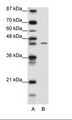 ZNF17 Antibody - A: Marker, B: Jurkat Cell Lysate.  This image was taken for the unconjugated form of this product. Other forms have not been tested.