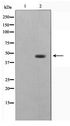 ZNF174 Antibody - Western blot of HeLa cell lysate using ZNF174 Antibody