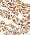 ZNF175 Antibody - Immunohistochemical of paraffin-embedded H.heart section using ZNF175 Antibody. Antibody was diluted at 1:25 dilution. A peroxidase-conjugated goat anti-rabbit IgG at 1:400 dilution was used as the secondary antibody, followed by DAB staining.