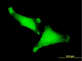 ZNF175 Antibody - Immunofluorescence of monoclonal antibody to ZNF175 on HeLa cell . [antibody concentration 10 ug/ml]