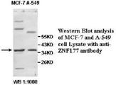 ZNF177 / PIGX Antibody