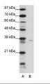 ZNF177 / PIGX Antibody - A: Marker, B: Transfected 293T Cell Lysate.  This image was taken for the unconjugated form of this product. Other forms have not been tested.