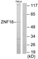 ZNF18 Antibody - Western blot analysis of lysates from HeLa cells, using ZNF18 Antibody. The lane on the right is blocked with the synthesized peptide.