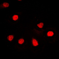 ZNF187 Antibody - Immunofluorescent analysis of ZNF187 staining in HL60 cells. Formalin-fixed cells were permeabilized with 0.1% Triton X-100 in TBS for 5-10 minutes and blocked with 3% BSA-PBS for 30 minutes at room temperature. Cells were probed with the primary antibody in 3% BSA-PBS and incubated overnight at 4 C in a humidified chamber. Cells were washed with PBST and incubated with a DyLight 594-conjugated secondary antibody (red) in PBS at room temperature in the dark. DAPI was used to stain the cell nuclei (blue).